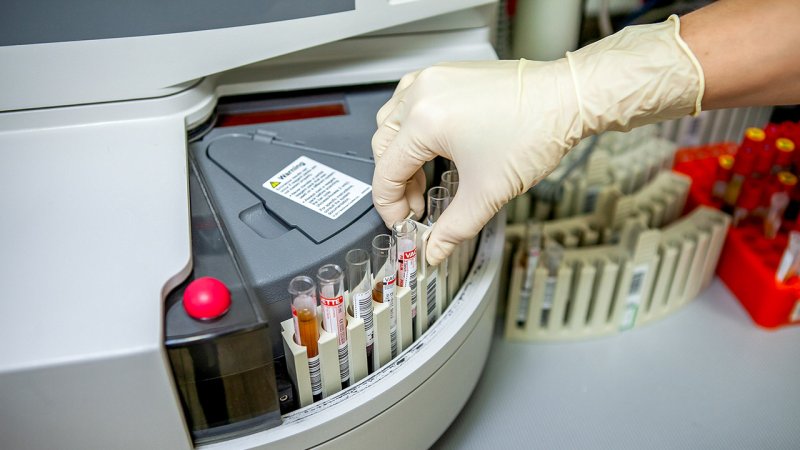 Personnel filling the laboratory centrifuge with samples. (Source: © Sergei Shavin / stock.adobe.com)